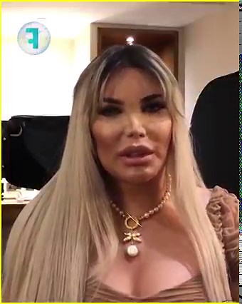 8.1M views · 122K reactions | Era hombre y se hacía llamar "El Ken Humano" luego dijo que quería ser deseado como mujer y ahora es la "Barbie humana", pero esta hermosa historia, aún no termina, pues quiere ser madre natural Esta es su hermosa historia  | Filosóraptor | Facebook