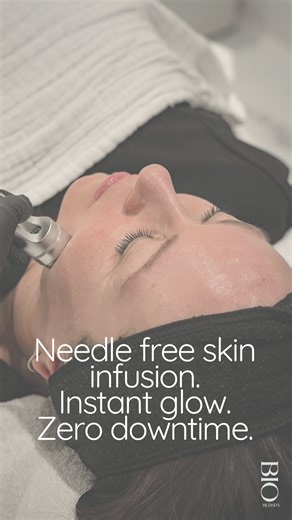 Electroporation is one of our favourite modalities for clients who want results without needles. Gentle electrical pulses open temporary pathways in the skin. Active ingredients travel deep without breaking the surface. No needles. No downtime. No irritation. This treatment suits clients who do not tolerate traditional microneedling. It also suits anyone who prefers a non invasive approach and still wants improvement in hydration, texture, tone, and glow. It is suitable for all skin concerns. Ac