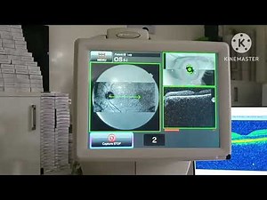 Topcon 3D OCT-1 Maestro 1 Full Demo , How To Use 3D Optical Coherence Tomography Aahil Raza 💯👁️👁️