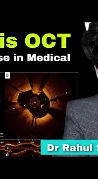What is OCT or optical coherence Tomography. How can we do better angioplasty using OCT.