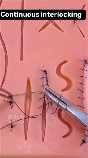 Continuous interlocking ♥️🔥🔥 | suturing practice | how to suture like a surgeon #shorts #suturing