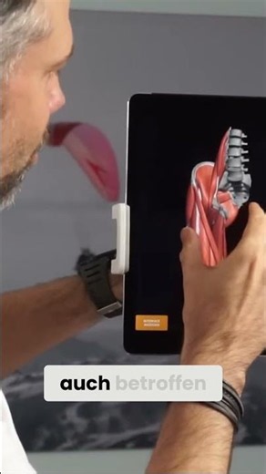 Understanding groin pain: Psoas major explained