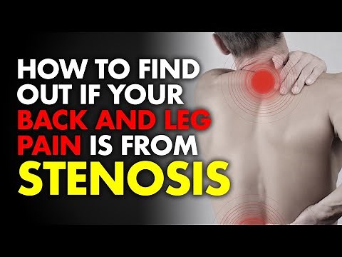 How To Find Out If Your Back and Leg Pain Is From Stenosis