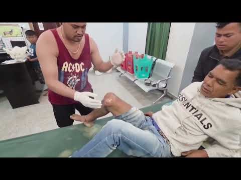 Knee Dislocate ( khuk nanthokpa) Indigenous Layeng Pathap Ataibi Mangang Treatment Center Lamding
