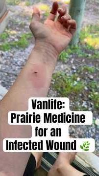 I Treated an Infected Cat Scratch with Prairie Medicine — Here’s What I Used