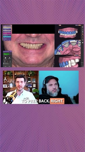 The Most Versatile Tool in exocad