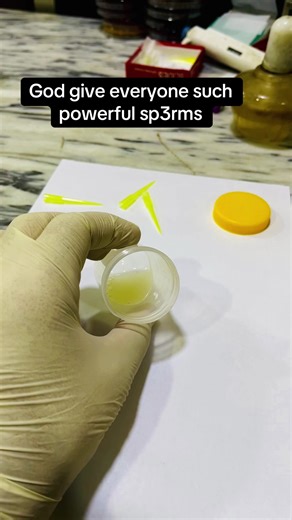 Understanding Semen Analysis for Fertility Insights