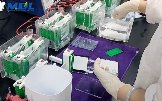 科研实验 | wb（western blot）实验流程操作