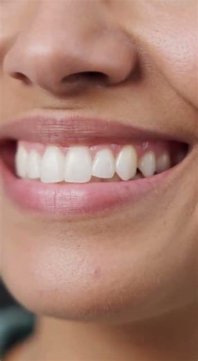 Has your dentist recommended removing multiple teeth? 🦷