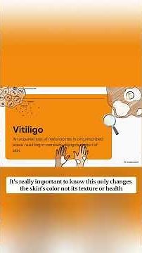 Understanding Vitiligo – GetSkinHelp Patient Education
