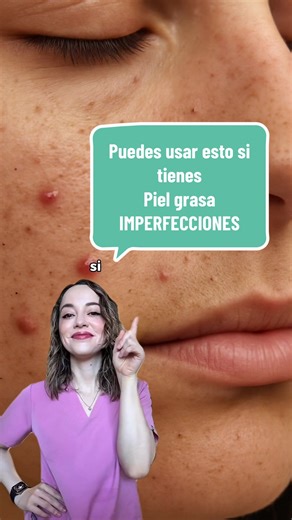 Productos Avene para el Acné: Soluciones Efectivas