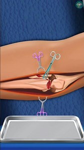 Extreme Hand Bone Fix-Up ASMR💀| Bone Adjustment & Healing Animation | Oddly Satisfying #shorts #asmr