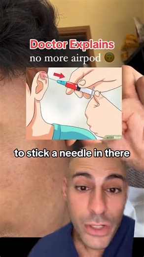 What is Cauliflower Ear? #mma #cauliflowerear #sports #doctor | David Abbasi, MD - Sports Medicine & Orthopedic Surgery