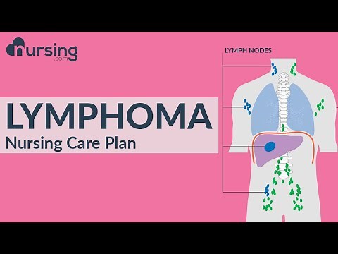 Nursing Care Plan for Lymphoma (Nursing Care Plan Tutorial)