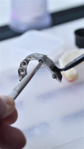 Essential Dental Lab Work Techniques for Success