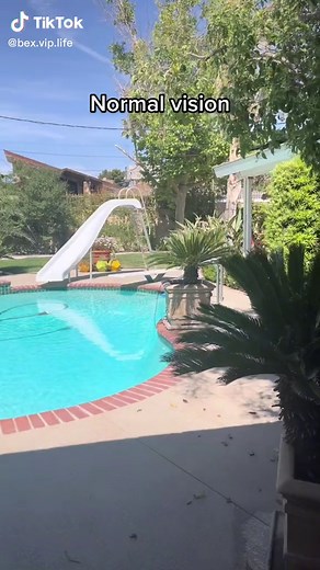 Central Vision Loss Simulation - Macular Degeneration & Blindness