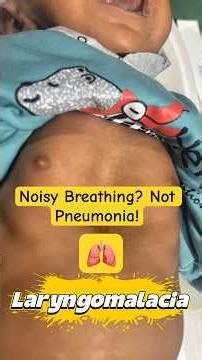 Noisy Breathing? Not Pneumonia! #shorts #noisybreathing #laryngomalacia .