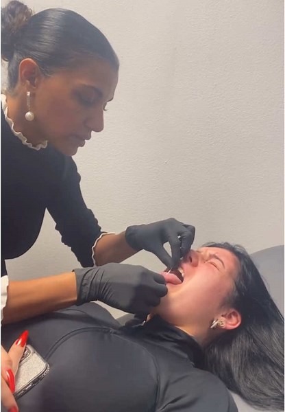 Experiencing a Tongue Piercing: What to Expect