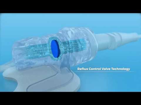 Jabil nCompass: Advanced IV Stabilization and Securement