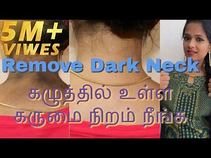 How to get rid of DARK NECK||simple and easy method||100%natural & effective||tamil youtuber