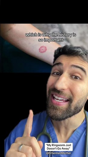 “My Ringworm Just Doesn’t Go Away” #why