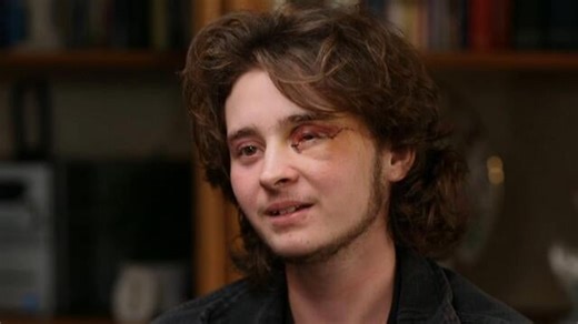 Protester says he's blind in one eye after federal agent fired less-lethal round at his face