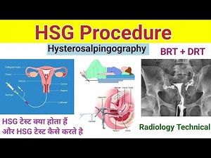 HSG Procedure # Hysterosalpingography # Investigation of Uterus & Fallopian tube #xrayclasses