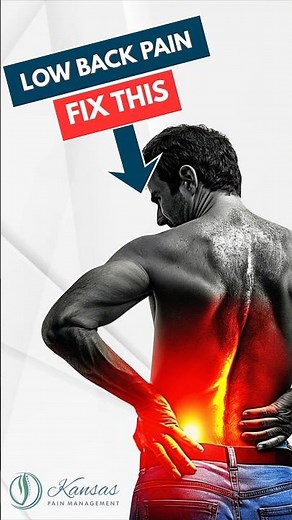 Lumbar Epidural for Back Pain Relief | Quick, Safe & Effective Treatment Explained. #backpainrelief