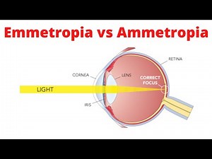 Emmetropia vs Ammetropia