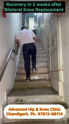 Recovery after Knee Replacement in 2 weeks. Back to work as a Police Officer