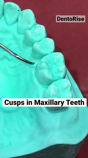 CUSPS in maxillary teeth |Landmarks on tooth surfaces| FULL VIDEO LINK IN DESCRIPTION | short video