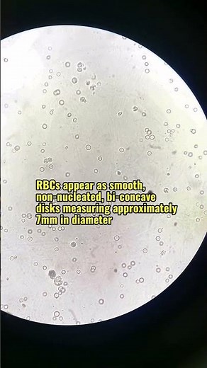 Red blood cell RBC in urine under the microscope ✅THE SIZE IS 7 MICROMETERS #urinalysis #laboratory
