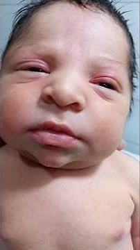 Newborn Healthy Baby NICU Care | Observation, Monitoring & Good Condition