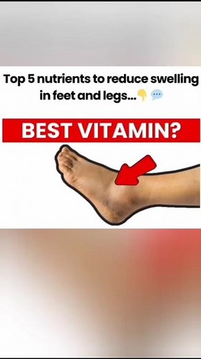 5 Nutrients That ACTUALLY Reduce Edema