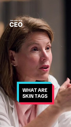 Understanding Skin Tags: What They Indicate About Your Health