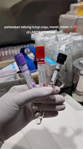 *📢📢📢 Promo‼️‼️* *Paket General Check UP LABORATORIUM PACAR✨* *Sering kali kita merasa sudah sehat padahal Kita tidak tahu bagaimana kondisi organ dalam tubuh dan status kesehatan Kita lebih jauh. Kalian jangan meremehkan gejala-gejala ringan yang ada pada tubuh, karena jika dibiarkan mungkin bisa menjadi suatu penyakit kronis.* *⭐Suport Alat By:* *🔬Erba XL 640* 🔥🔥🔥Dari Harga ~*1.200.000*~ Menjadi Hanya *280.000*,-🔥🔥🔥 *_✅ Paket General Check Up termasuk :_* *HEMATOLOGI LENGKAP* • (18 Pa