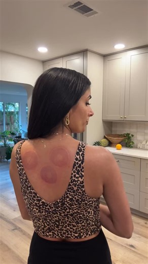 All Good With Aneesa on Instagram: "At home cupping has saved me so much money! It’s one of my favorite things to do to relive tension and muscle soreness. This one also has heat and red light therapy built in which is a major bonus! Comment CUPPER and I’ll send you the link ❤️ . . #redlight #muscle #cupping"