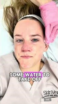 PRX Derm Perfexion Skin Treatment | No-Peel Glow & Collagen Boost