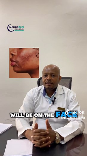 Understanding Acne: Expert Advice from Dermatologist Dr. Joffrey Mokio