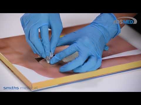 Smiths Medical | Gripper Plus Needles