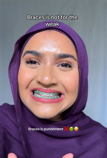 Navigating the Challenges of Braces