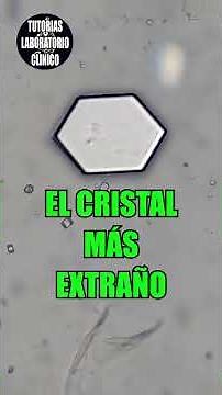 🪨Crystals that cause KIDNEY STONES. What are they and what do Triple Phosphates in Urine mean?
