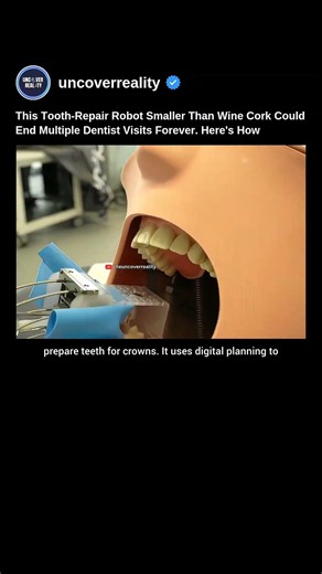 This Tooth-Repair Robot Smaller Than Wine Cork Could End Multiple Dentist Visits #robot #shorts