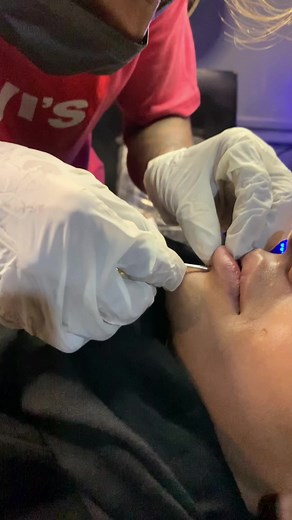 Lower lips piercing ❤️‍🔥#lowerlips #fyp #piercing