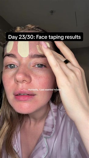 Transforming My Skin: Face Taping Results