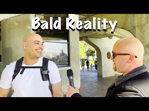 The Truth About Being Bald | Ep. 1