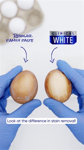 Looking for two shades whiter teeth? Watch our EGGsperiment and see the difference with Sensodyne Clinical White. | Sensodyne