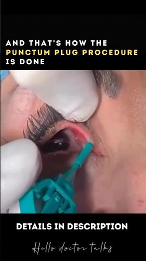 Punctum Plug Procedure Details in description 👍 #healthchannel #doctor