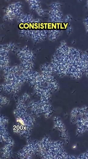 What insulin looks like under a microscope is more complex than you think