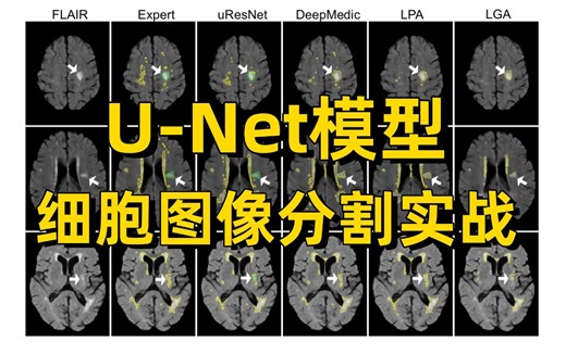 【附源码】毕设有救了！基于U-Net模型实现医学细胞图像分割，原理详解+项目实战，看完就能跑通！(深度学习/计算机视觉)